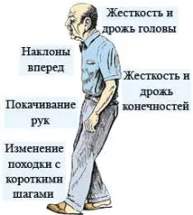 прогноза ефекти