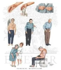болест прогноза