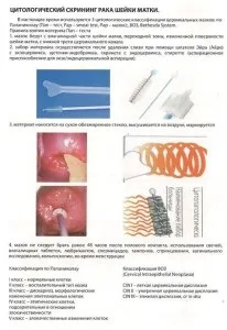 Цервікальний скринінг шийки матки