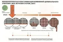 Цервікальний скринінг матки