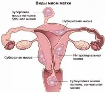 защо защо
