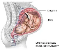 човешка цитомегаловирусна