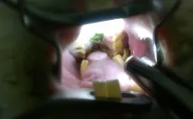зъбно
