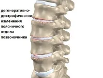 хребта