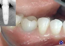 ясенної