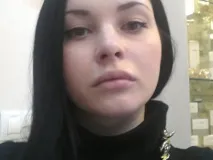 Філлер Ювідерм ультра 3 та смайл для носогубних складок та губ протипоказання до застосування, фото та ювідерм