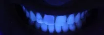 ФЛУОРЕСЦЕНЦІЯ КОМПОЗИТНИХ МАТЕРІАЛІВ - Dental Magazine матеріалів