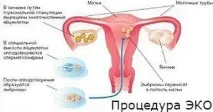 ускладнення