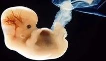 хиперстимулация хиперстимулация