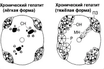 хепатит мъжете