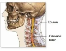 симптоми прешлени
