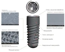 Імплантація зубів система CSM Implant Apolonia apolonia