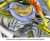 стълб отдел