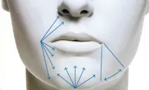 juvederm