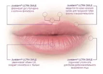juvederm