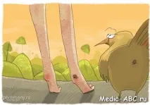 дупе лекуваме