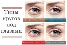 Як швидко прибрати кола під очима. швидко
