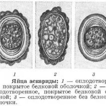 Як відбувається зараження аскаридами особливості розвитку інфекції, можливі шляхи передачі особливості