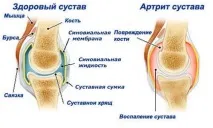 звернутися