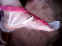 пилинг киселинен