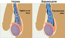 част част