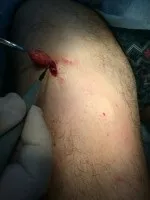 беше конкретно лечение