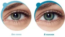Лінзи Acuvue Oasys особливості використання acuvue