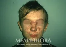 лікування
