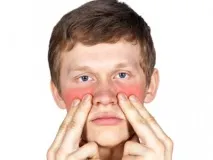 синузит синузит