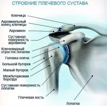 періартрозу