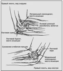 лакътната става