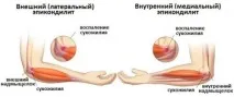 лечение дома