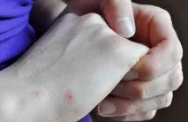 спукват спукват