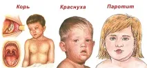Чи можна робити дитині щеплення при нежиті робити