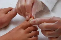 корекция нокти