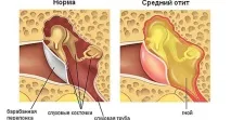 лікування
