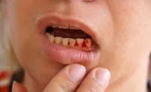 след имплантация