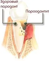 royal-smile устната кухина