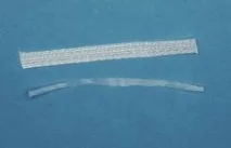 Пародонтальне шинування за допомогою Ribbond THM (частина 2) шинування