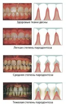 устната кухина стоматология