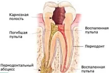 защо какви