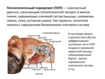 раменно-лопаточен раменно-лопаточен