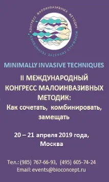 входовете защо