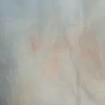Після Кліону Д виділення рожеві, кров’янисті, при місячних, вагітності після