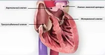 intercardio аортна стеноза