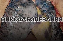 також