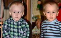 Причини косоокості у дітей до року, до 3 років і старше дітей