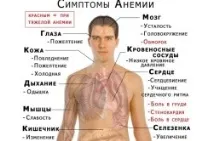 анемия анемия
