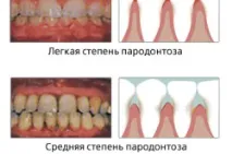 метаболитните процеси метаболитните процеси