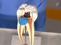 причини
